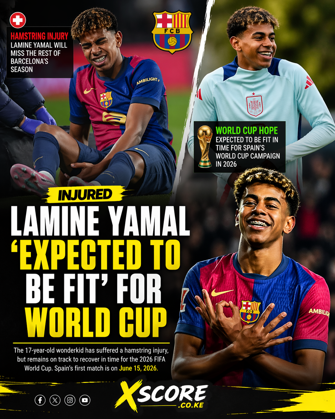 Read more about the article Lamine Yamal injury update: Barcelona expect winger to be fit for World Cup